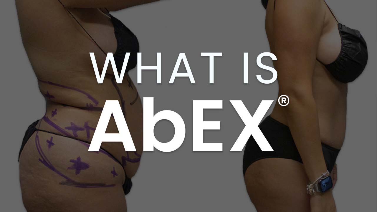 What is AbEX