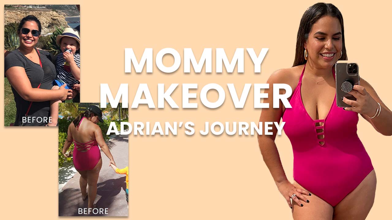 Mommy Makeover: Adrian's Journey