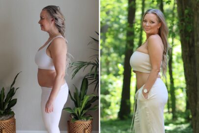 Christy before and after Sono Bello AbEX