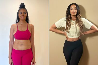 Vanessa Simmons before and after Sono Bello liposuction