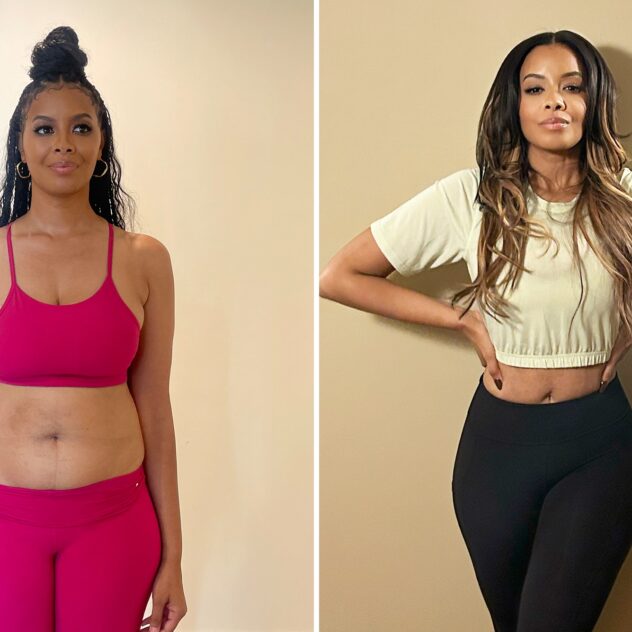 Vanessa Simmons before and after Sono Bello liposuction