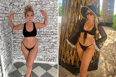 Meghan Linsey before and after TriSculpt lipo at Sono Bello