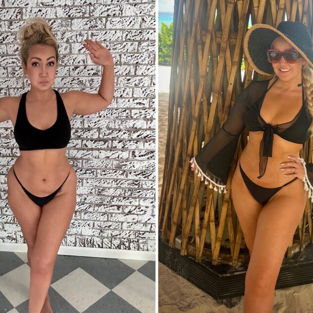 Meghan Linsey before and after TriSculpt lipo at Sono Bello