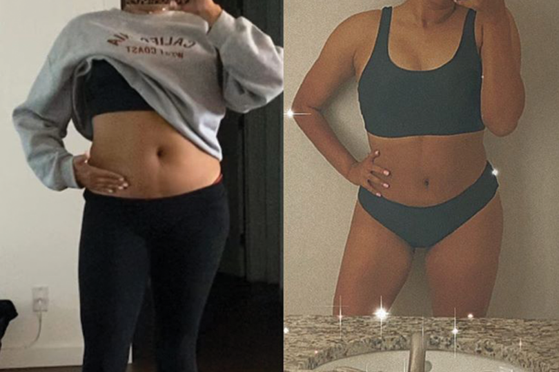 Before and after comparison of a woman showing body transformation with the help of Sono Bello treatment.