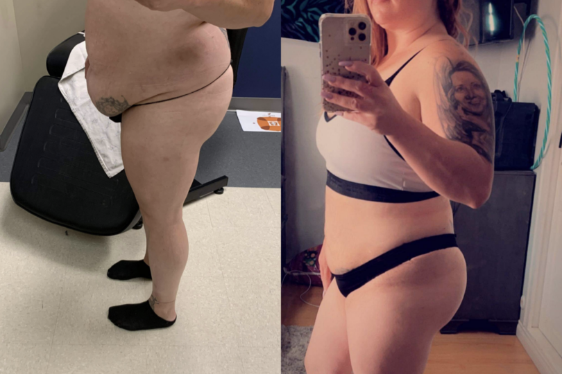Before and after weight loss comparison of a woman standing indoors, showcasing body transformation in two mirror selfies.