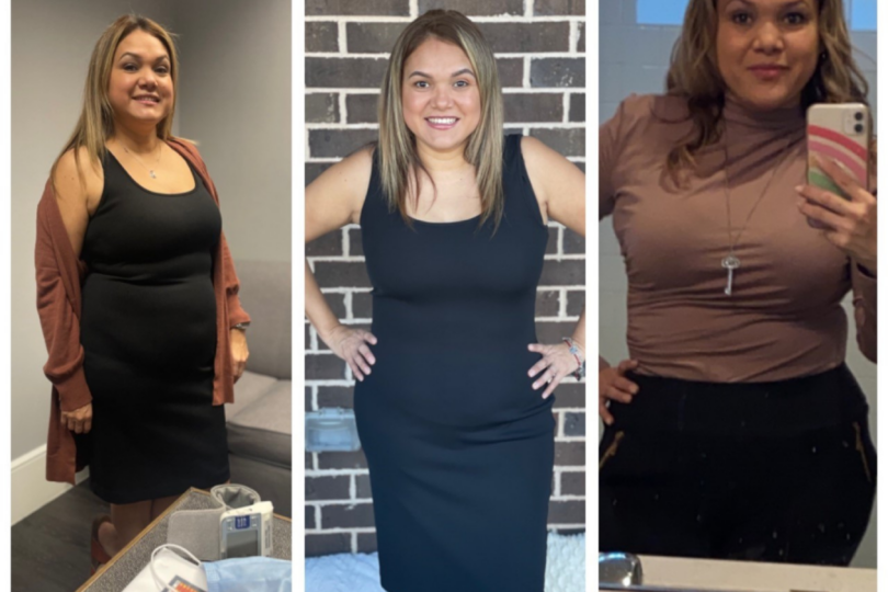 Before and after images showing a woman's weight loss transformation in three different outfits.