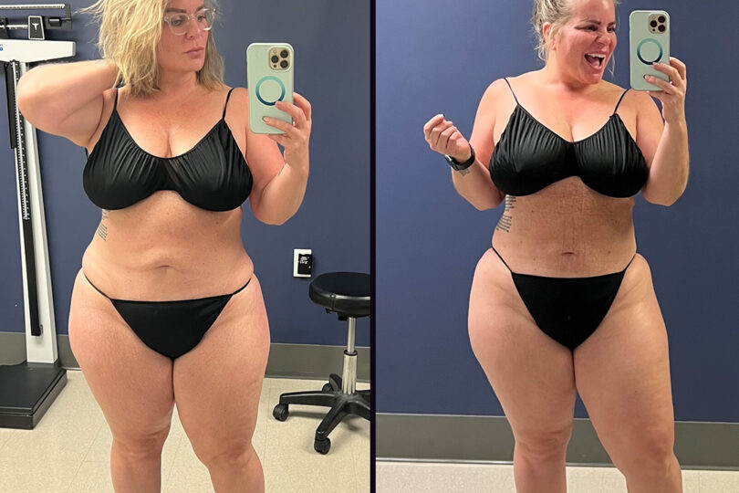 Woman in black lingerie showing weight loss transformation in before and after photos.