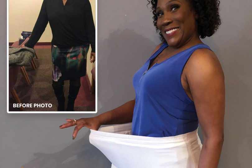 Woman smiling in a blue top showing weight loss results by wearing oversized skirt, with a before photo in the background.
