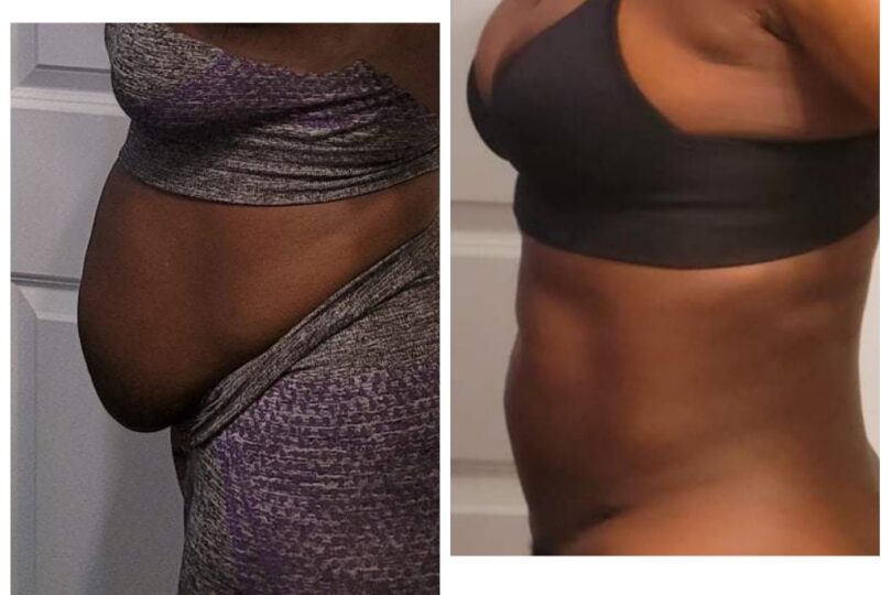 Before and after side profile showing weight loss, with noticeable difference in waist size.