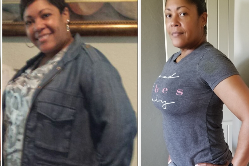 Before and after photos of a woman showing weight loss transformation.