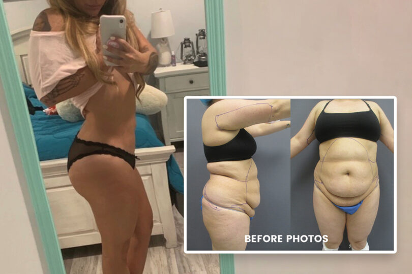 Woman taking a mirror selfie, inset photo showing before and after weight loss comparison.