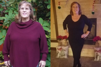 Before and after weight loss comparison of a woman standing outdoors and indoors, wearing different outfits.