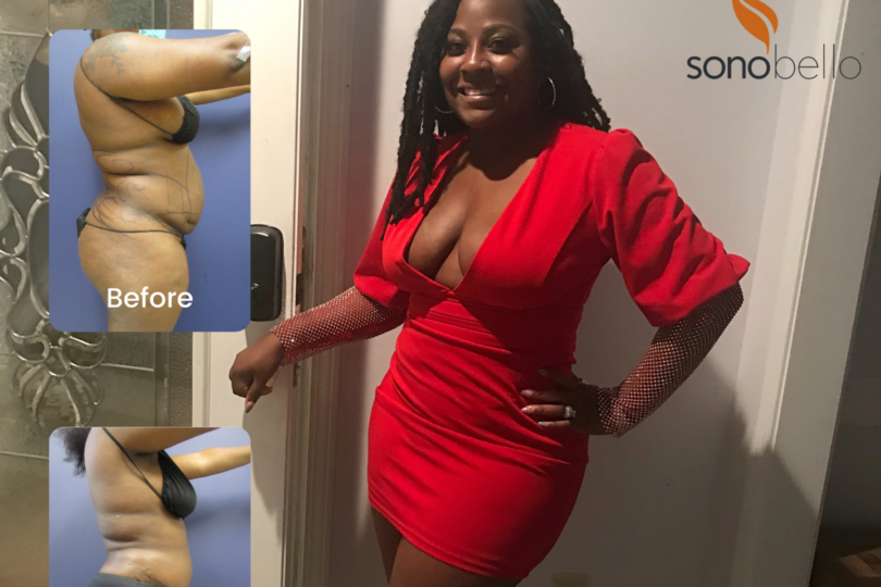 Woman in a red dress smiling, with two inset images of skin treatment results labeled "before" and "after" on the left.