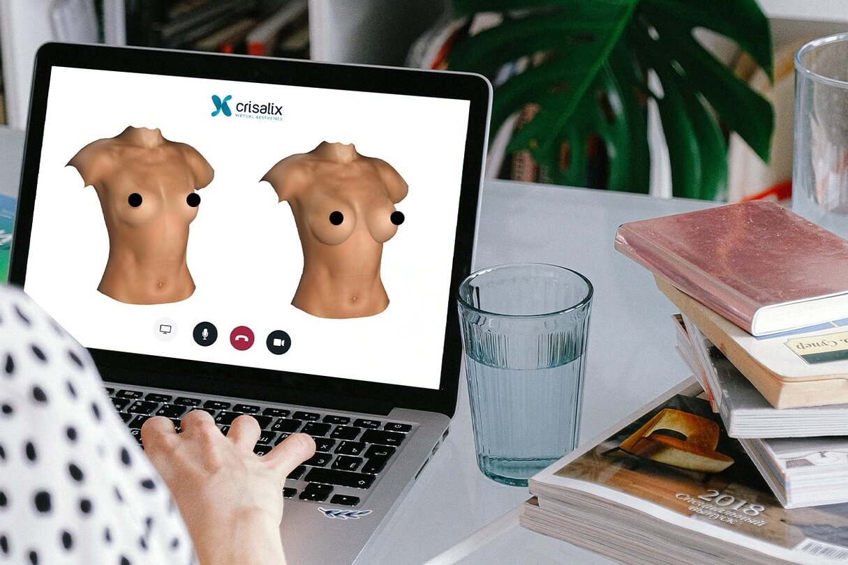Patient using breast augmentation results simulation online