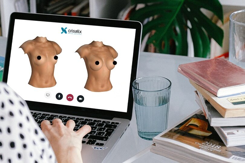 Patient using breast augmentation results simulation online