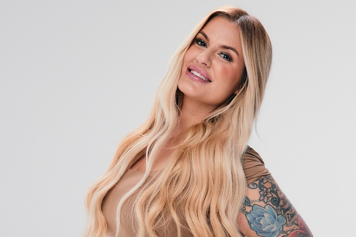 Sono Bello patient with defined jawline