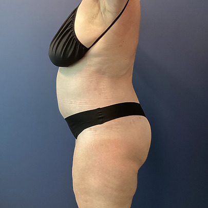 Person in black swimsuit posing sideways against a blue background.