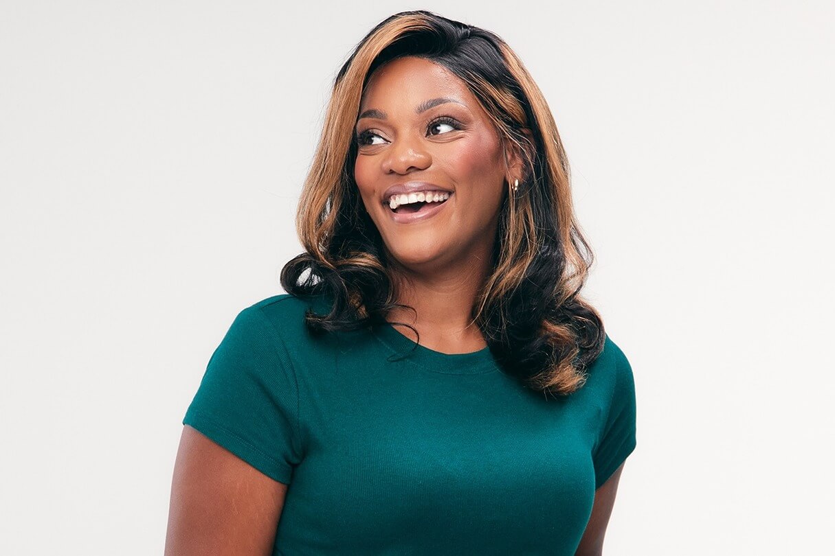 Sono Bello patient results after chin fat removal