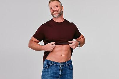 Patient showing targeted fat removal results