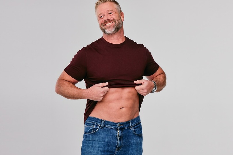 Patient showing targeted fat removal results