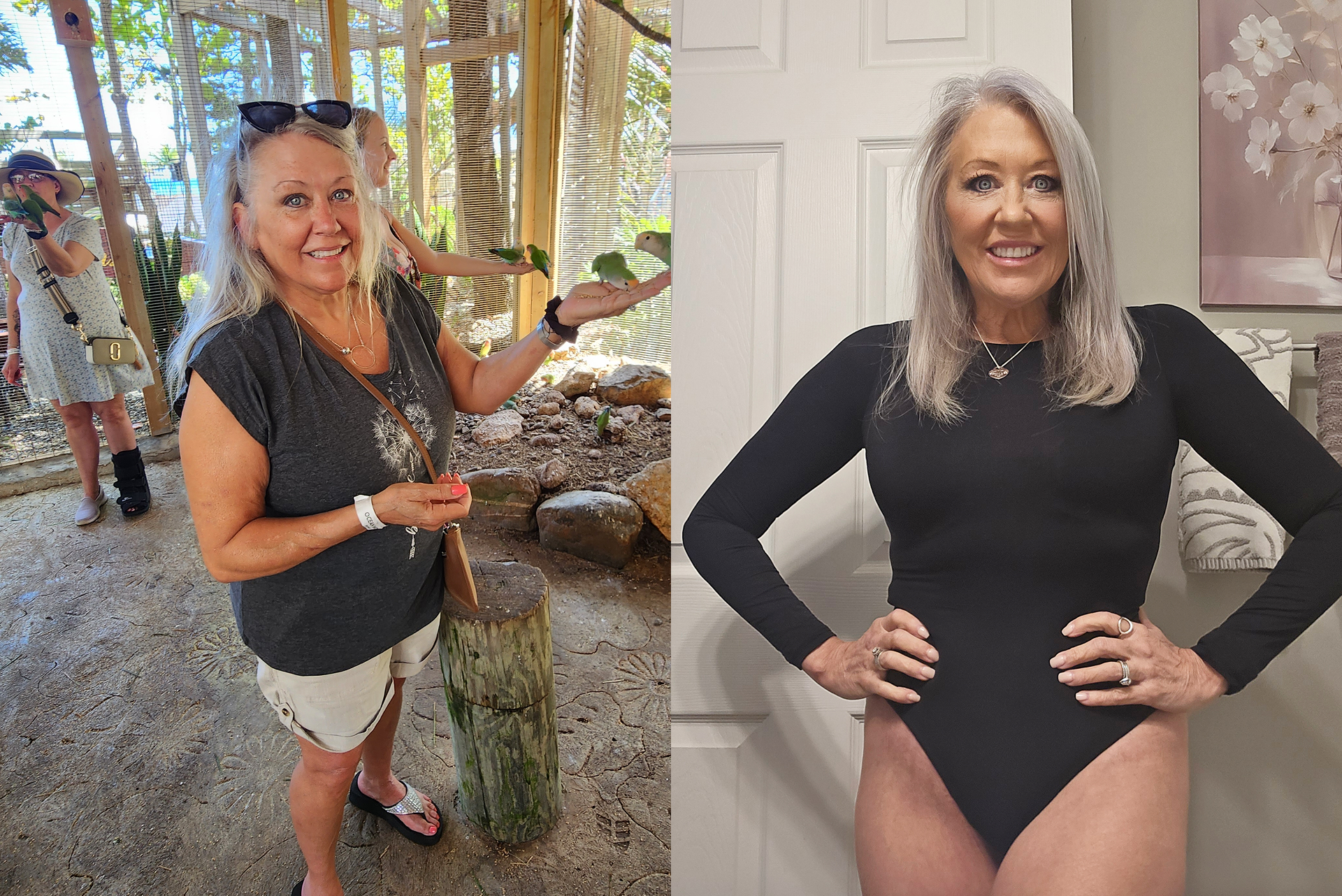 Cosmetic Surgery Options for Menopause Weight Gain | Sono Bello