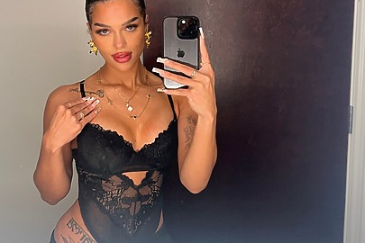 Sono Bello patient selfie after breast augmentation