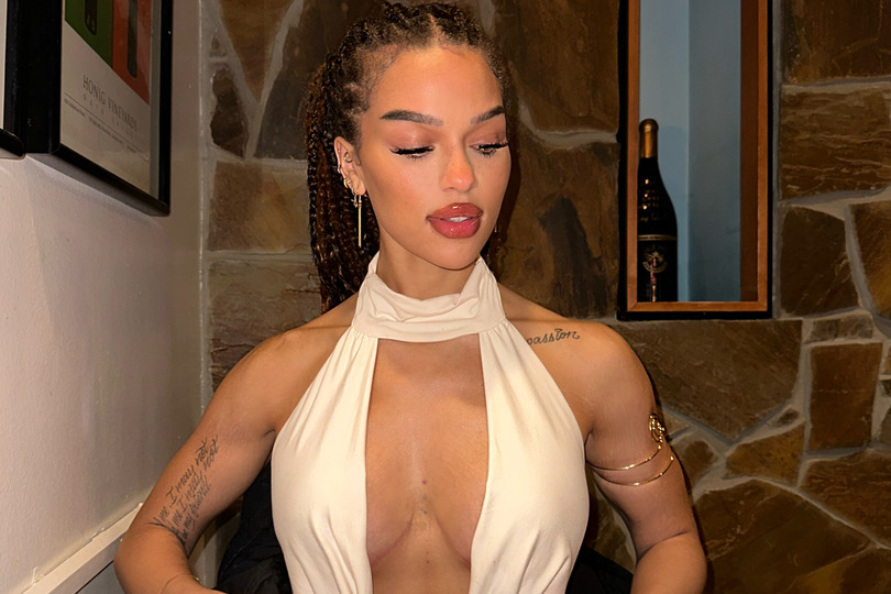 Sono Bello patient after breast augmentation