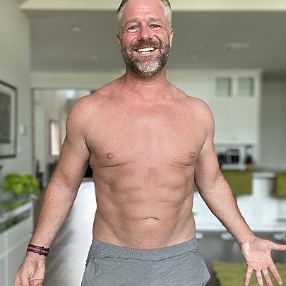 Male Sono Bello patient after liposuction procedure