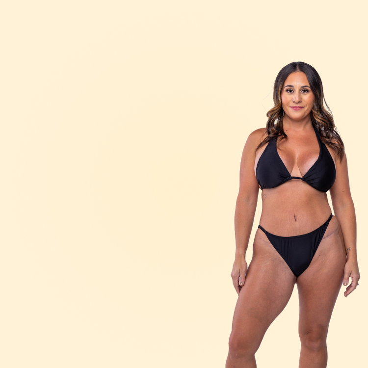 Sono Bello permanent fat removal