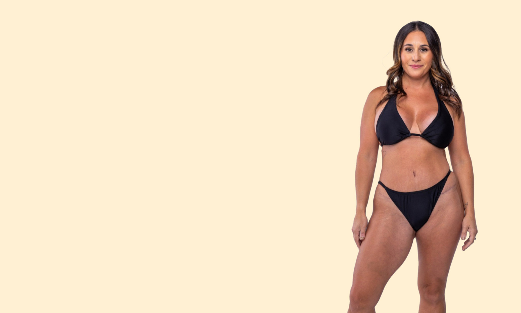 Sono Bello ambassador after laser liposuction with yellow background