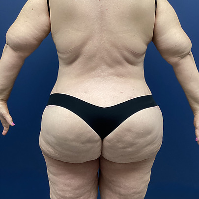 A person in black underwear showing back, standing against a dark blue background.