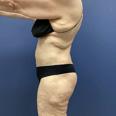 Person in black swimwear showing side profile against a blue background.