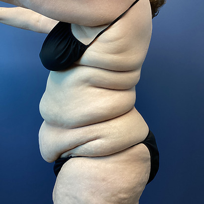 Person in black swimsuit showing side profile against blue background.