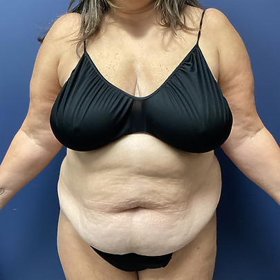 Person wearing black undergarments standing against a blue background.
