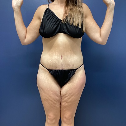 Woman in black bikini standing with arms raised against a blue background.
