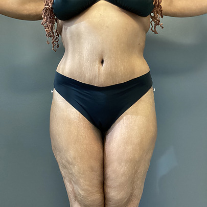 Person in black bikini standing against a gray background, arms extended, displaying natural body features and curves.