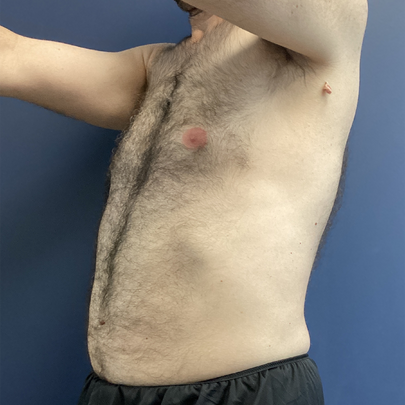 Person in black shorts with a bare chest and arms raised against a blue background