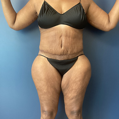 Person in black underwear standing against a blue wall, showing body transformation progress.