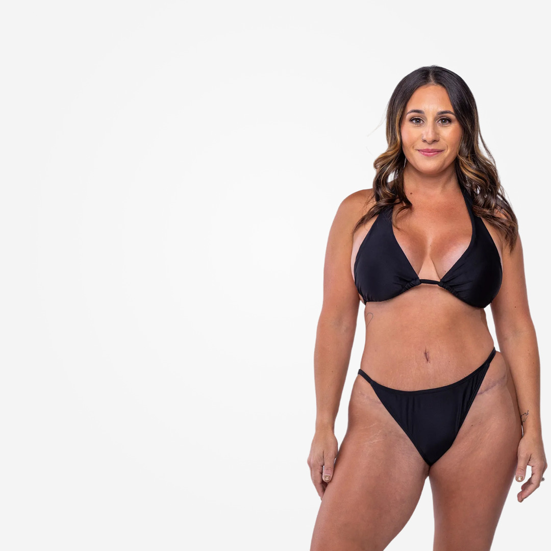 Woman posing after TriSculpt laser liposuction in black bikini posing against a plain white background, smiling with a relaxed and confident posture.