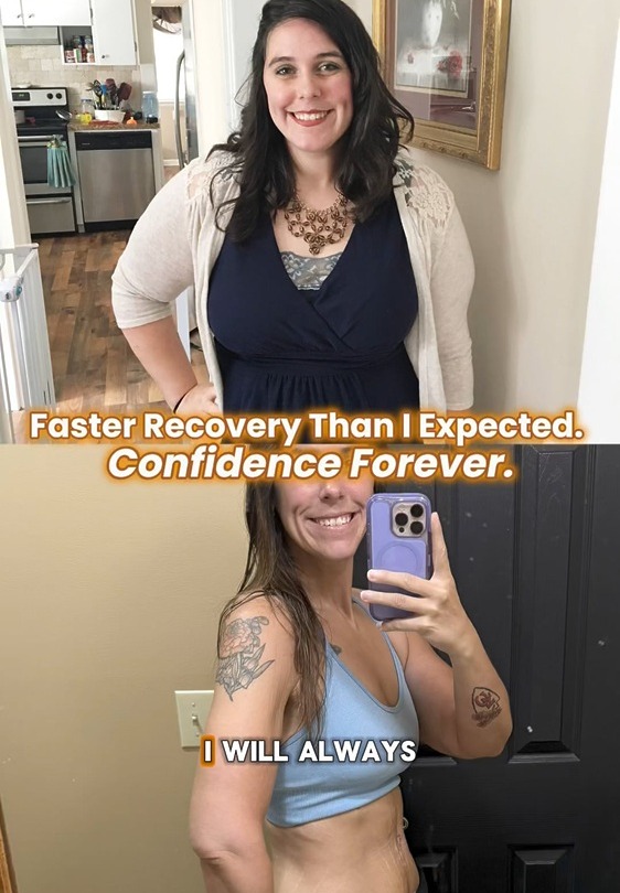 Two images of a person before and after a transformation, with text about fast recovery and confidence.